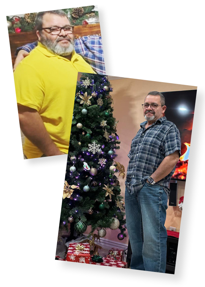 Before and After Photos — Baltazar's weight loss journey with the best bariatric surgeons in Arkansas at Arkansas Heart Hospital's Bariatric and Metabolic Institute
