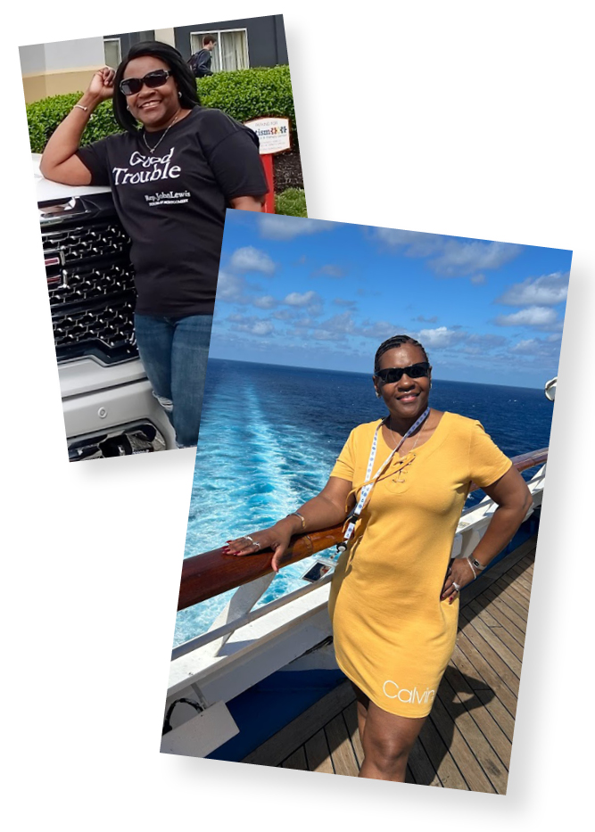 Before and After Photos - Pamela's weight loss journey with the best bariatric surgeons in Arkansas at Arkansas Heart Hospital's Bariatric and Metabolic Institute.